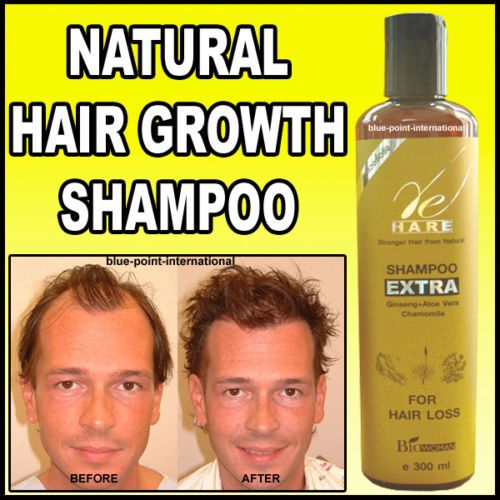 HAIR LOSS   SHAMPOO TREATMENT   REGROWTH GROW **NEW**  